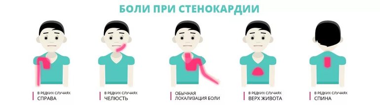 Может возникнуть мгновенно