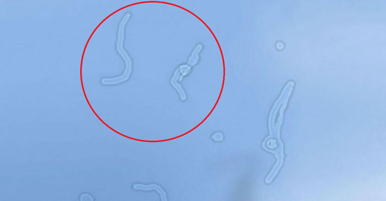 Всевозможные объяснения мушек в глазах