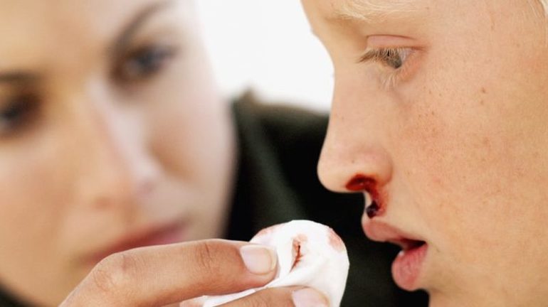 Выделение крови из носа